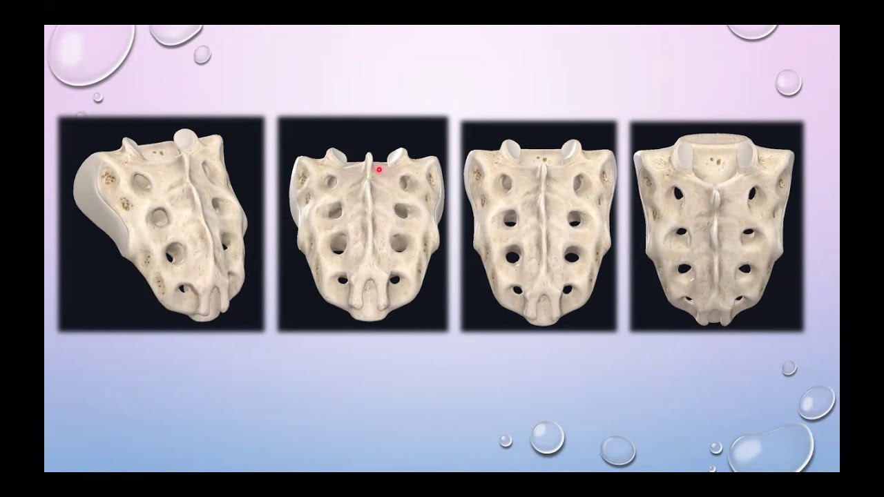 PRACTICAL:Bony pelvis and pelvic muscles