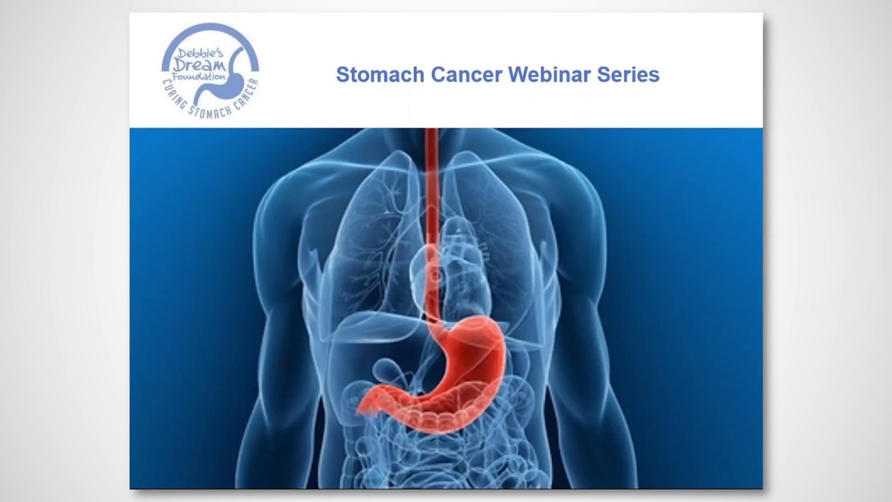 2017 FREE Stomach Cancer Webinar - The role of bacteria in the development of stomach cancer