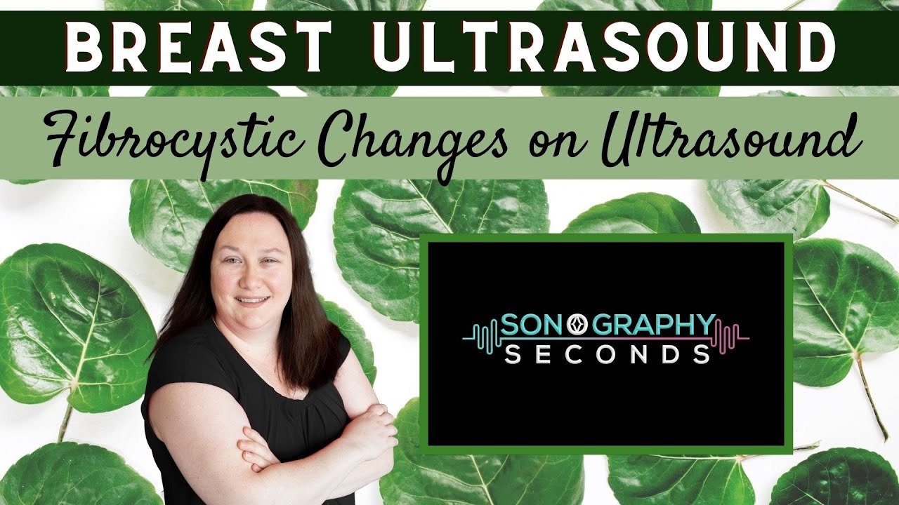 Breast Ultrasound- Fibrocystic Changes (Sonography in Seconds Series)