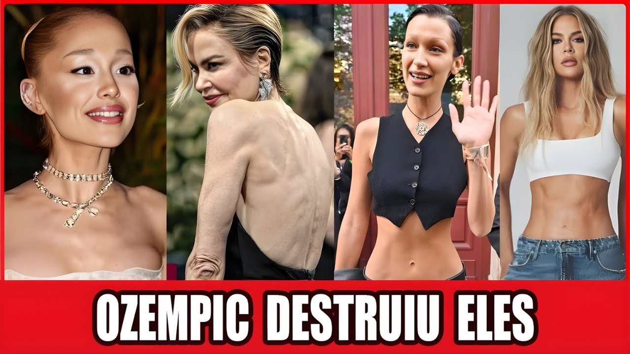21 Estrelas De Hollywood “Destruídas” Pelo Ozempic: Beleza Rápida, Preço Alto!