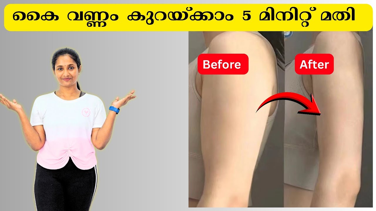 കൈവണ്ണം കുറച്ച് കൈTone ചെയ്യാം💯 കൈകൾ തൂങ്ങി നിൽക്കുന്നവർക്ക് വളരെ ഉപകാരപ്പെടും🫶 #armfatloss |Soorya 