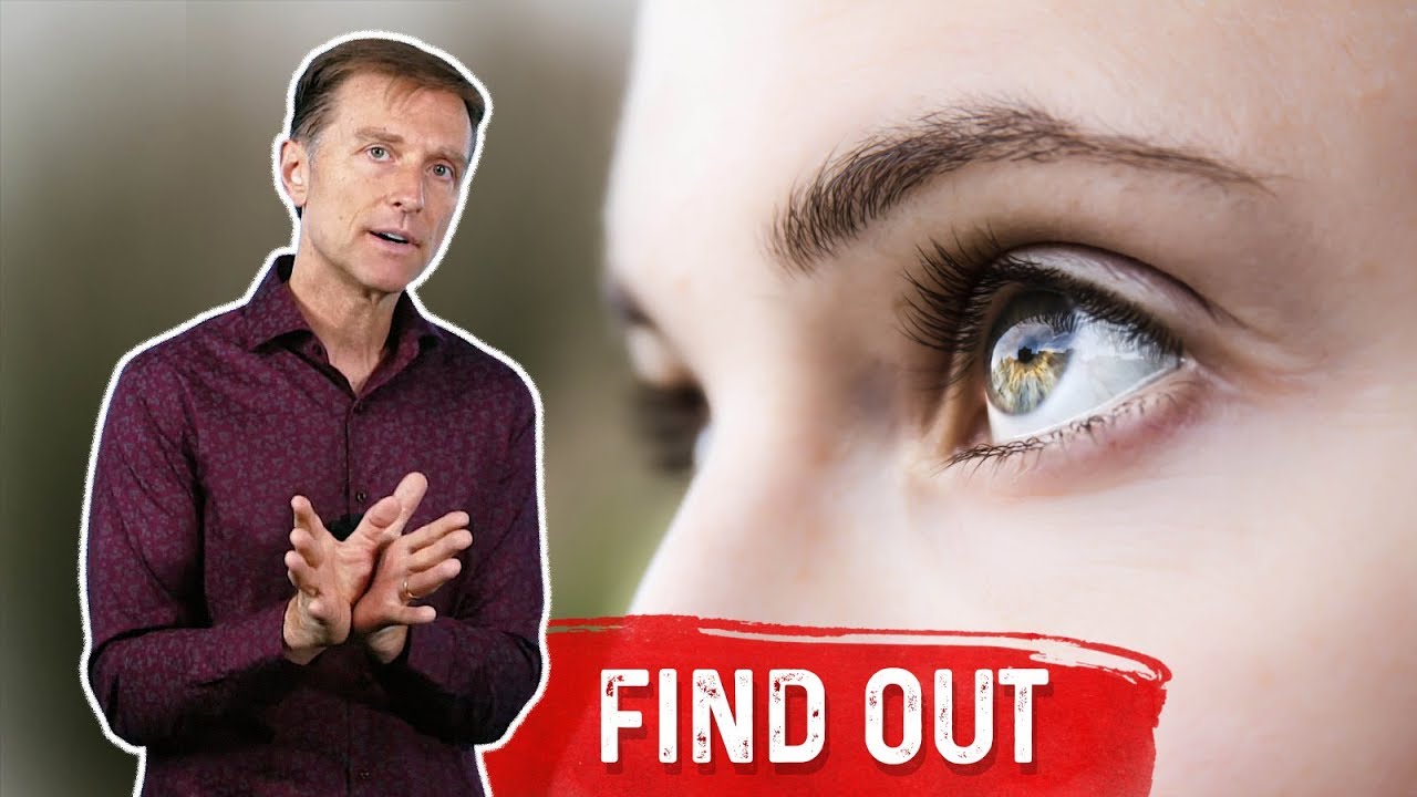 7 Things Your Eyes Can Tell You About Your Blood Sugars &ndash; Dr.Berg