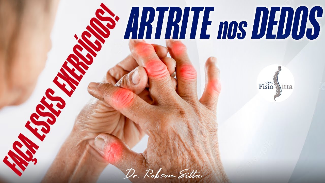 EXERCÍCIOS para MELHORAR a DOR ARTRITE nos DEDOS da MÃO - Clínica de Fisioterapia Dr. Robson Sitta