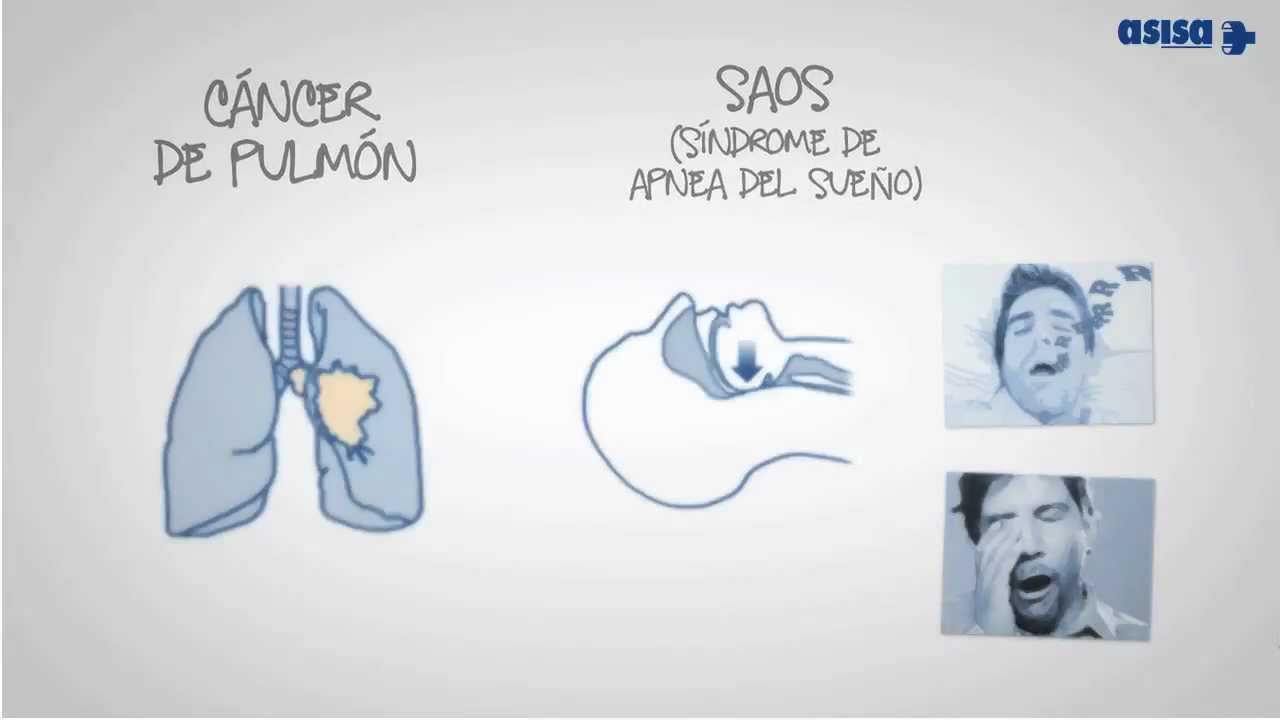 Qu&eacute; es la neumolog&iacute;a