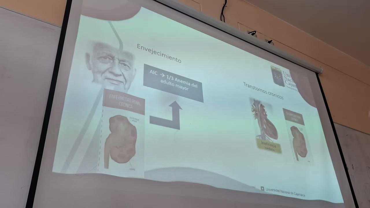 14  Anemia de enfermedad crónica   Dr  Iván