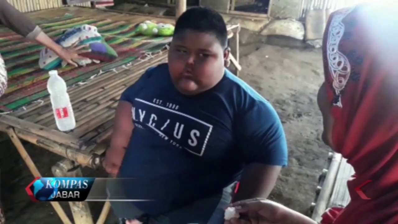 Orang tua Anak Obesitas Satya, Menolak Tindakan Operasi