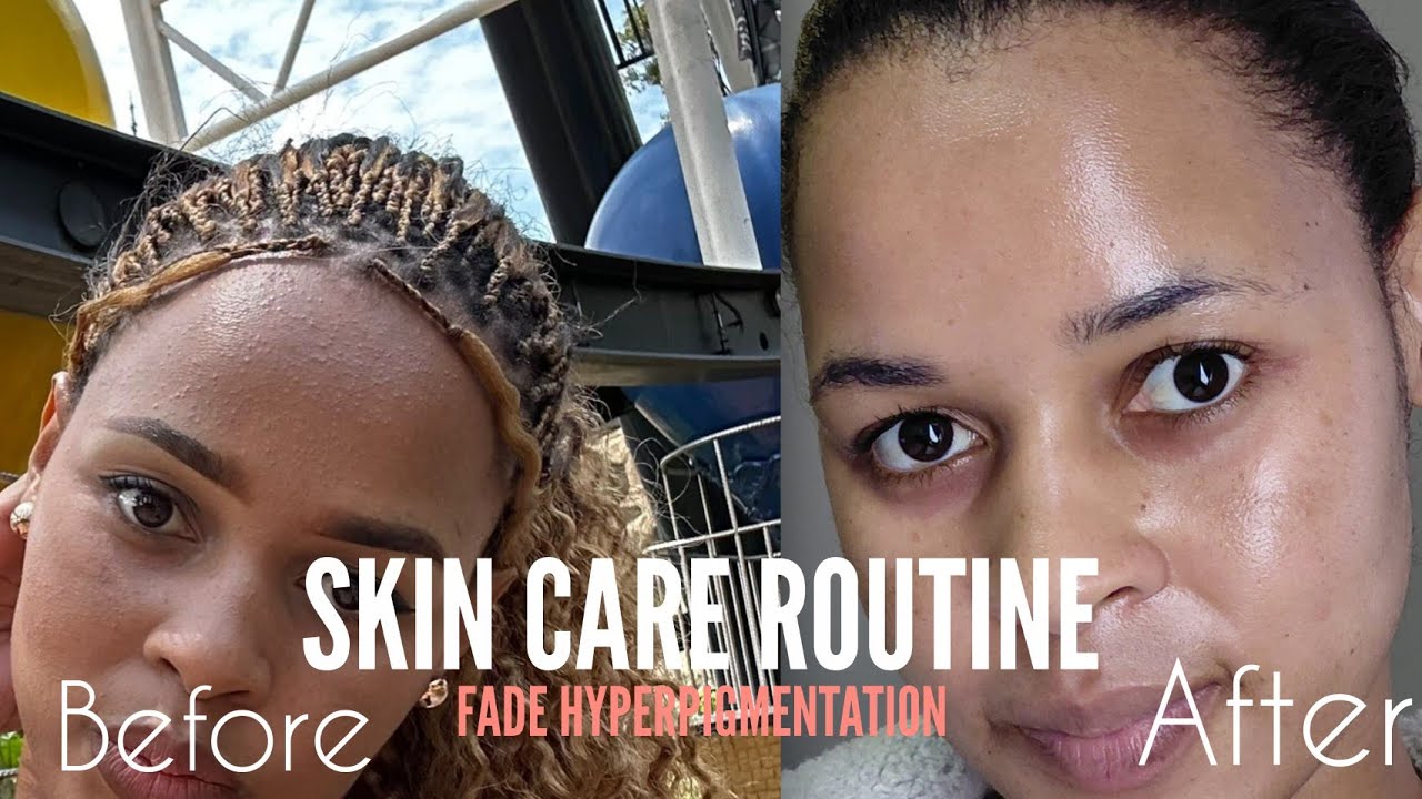 My Night Skincare Routine to Fade Hyperpigmentation ✨ | Affordable skincare CLRS  from Jet