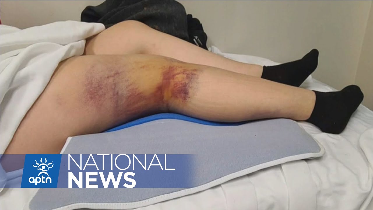 Alberta police watchdog to investigate Yukon RCMP arrest | APTN News