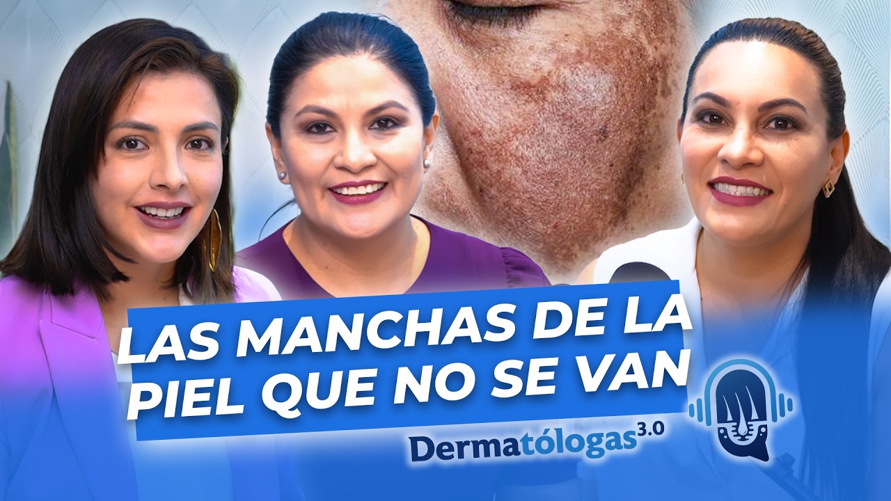 ¿Por qué las manchas en la piel NO desaparecen? Podcast Ep  2   Dermatólogas 3 0