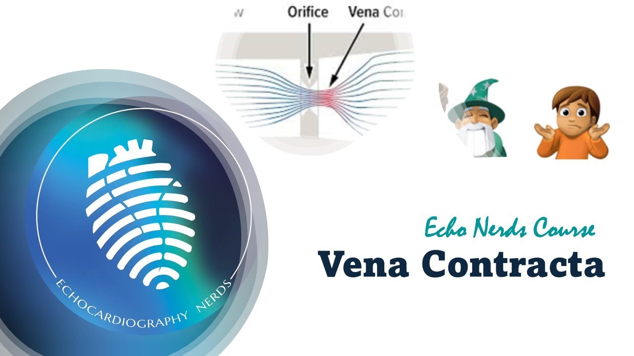 How to Assess Vena Contracta (VC) in Mitral regurgitation (MR)