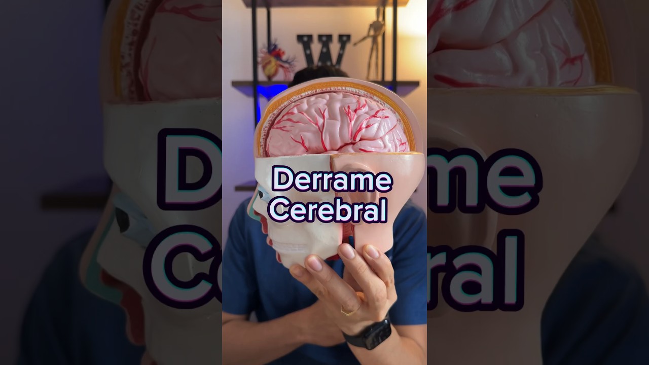 Se&ntilde;ales de que est&aacute;s sufriendo un derrame cerebral | Dr. William Guerrero. #medicina #shorts