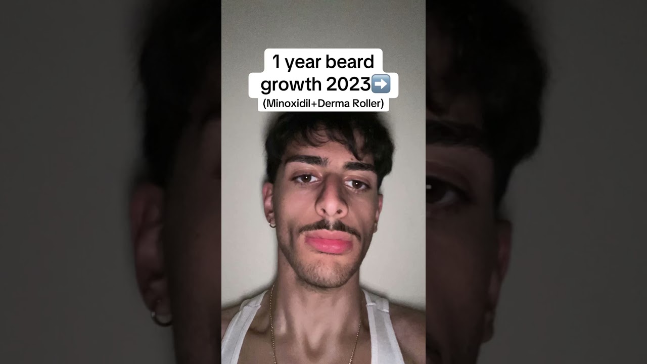 1 year beard growth journey #minoxidil #beard #transformation #shorts