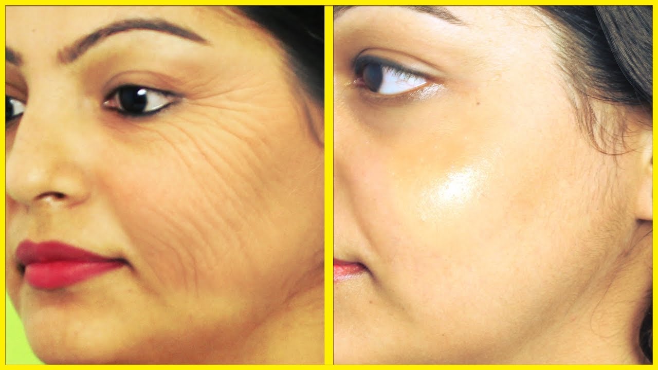 चेहरे की झुर्रियों को हटाने के घरेलु उपाय | Best Home Remedies for Wrinkles