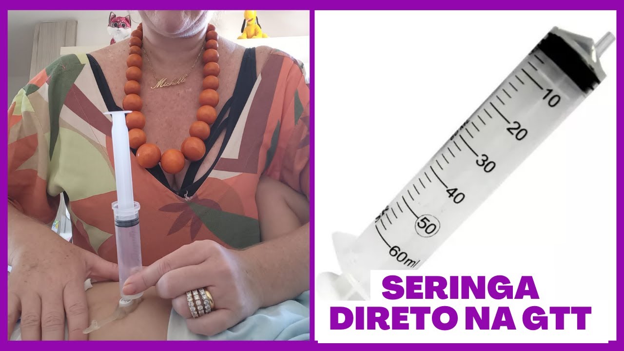 Como dar dieta usando a seringa direto no bottom de gastrostomia . Uma forma funcional e rápida.