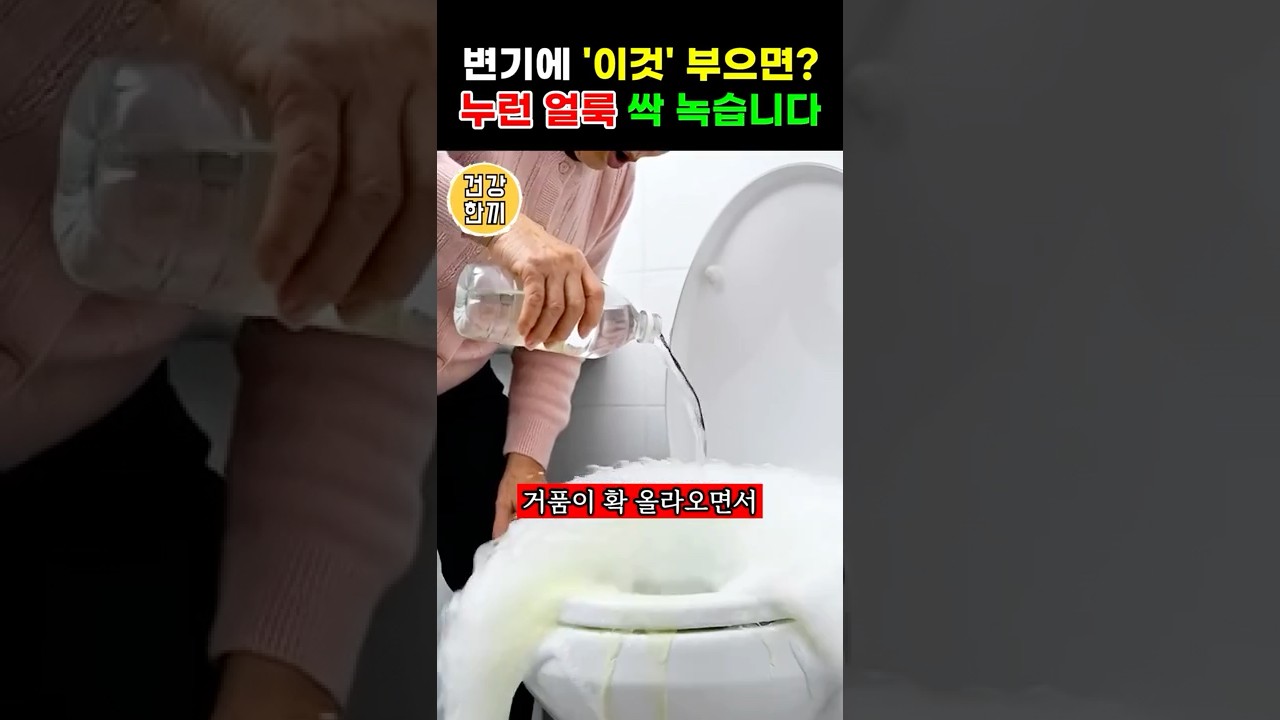 변기 누런 소변 '이것' 부으면? 거품 확! 얼룩 싹 녹습니다 