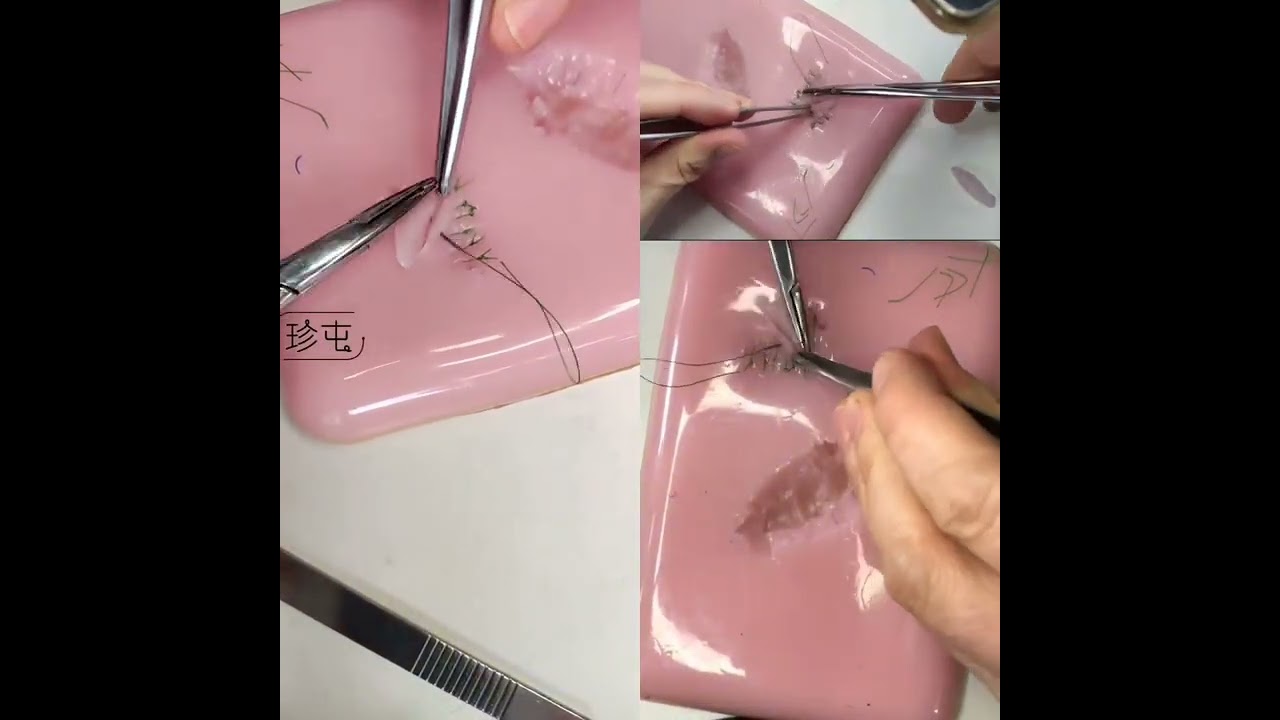 Basic training 63  Z plastic surgery