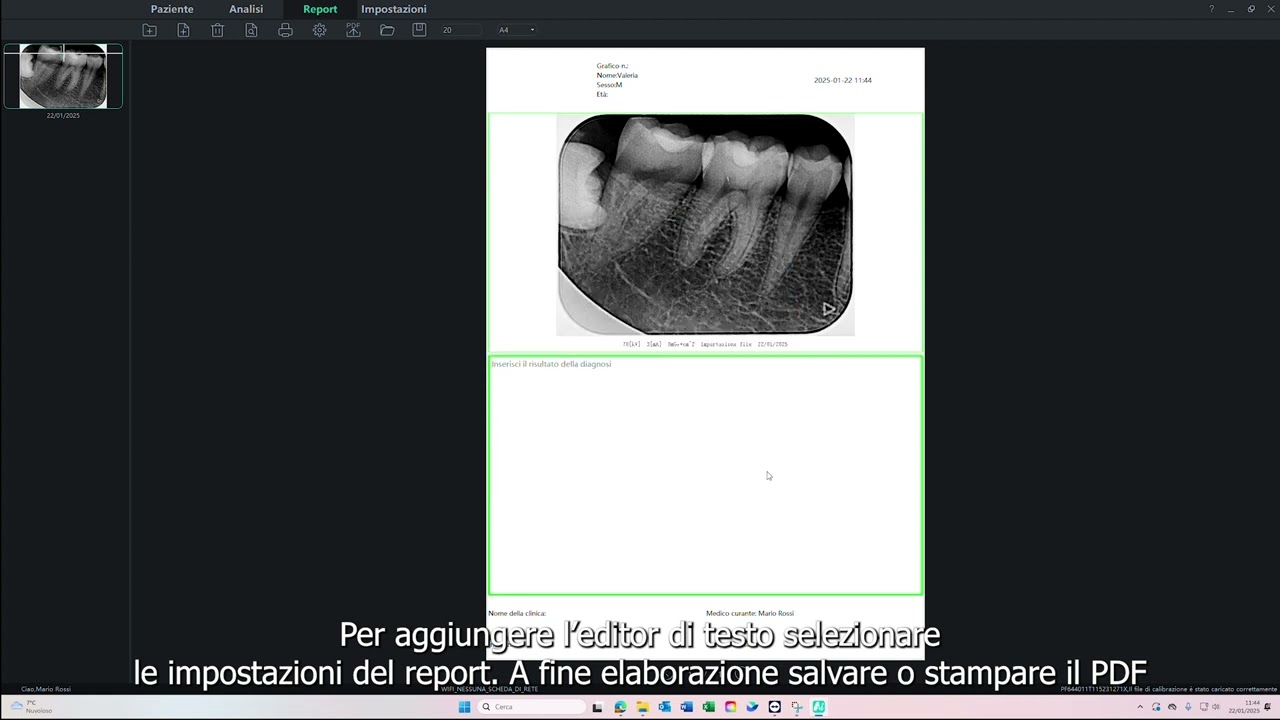 Installazione e formazione Ai-Dental
