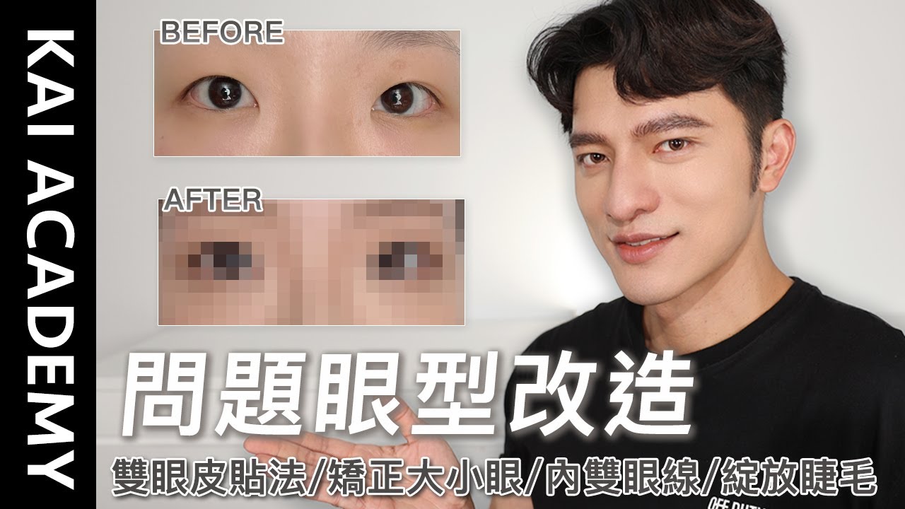 『凱學院』問題眼型改造！雙眼皮貼法！矯正大小眼！超實用完整教學示範！人人必學～