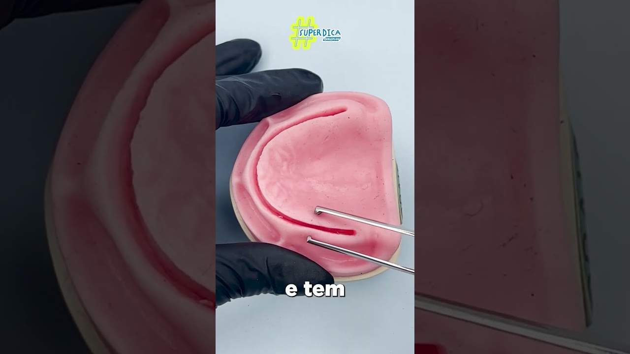 Pin&ccedil;a Anat&ocirc;mica e Dente de rato #golgran #odontologia