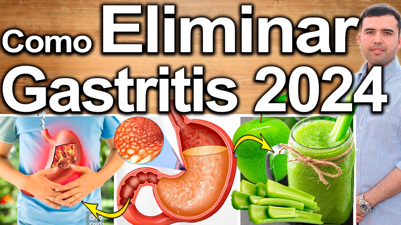C&Oacute;MO ELIMINAR LA GASTRITIS 2024 - Soluciones Para Quitar La Acidez&nbsp;Estomacal