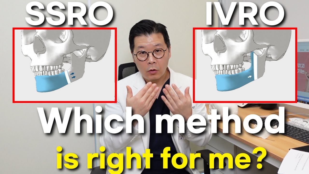 2 methods of double jaw surgery! IVRO, SSRO How should we cut the jawbone?