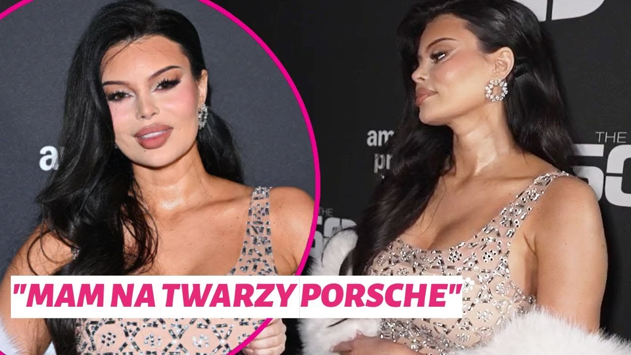 Justyna Gradek mówi, ile kosztowała ją nowa twarz!