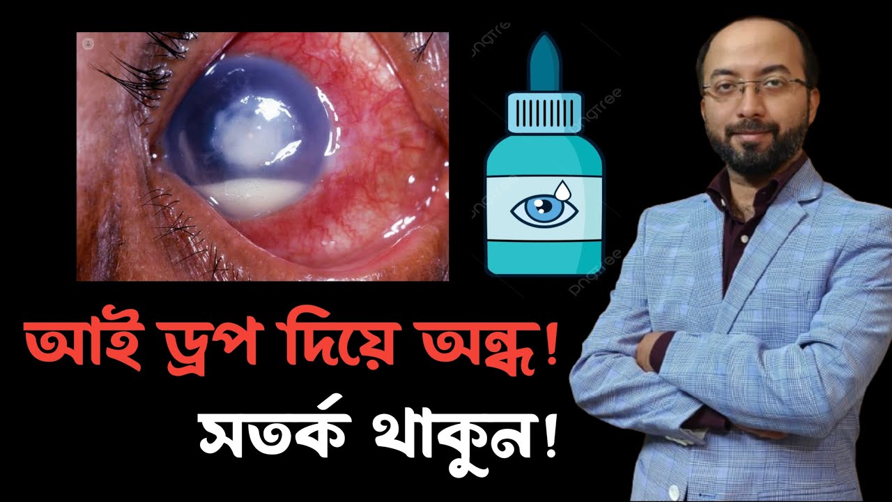 চোখ লাল হলে ভুল করেও এই ড্রপ ব্যবহার করবেন না | চোখ লাল হলে করণীয় #চোখ লাল #চোখের ড্রপ#চোখ