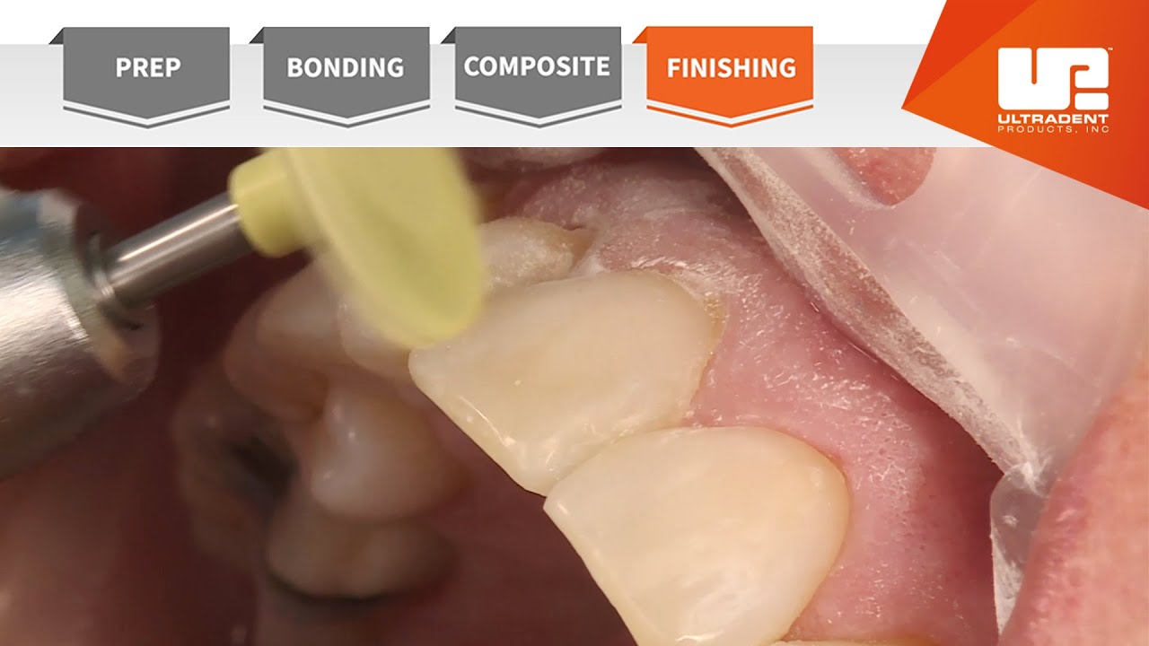 Finishing | Your Complete Restorative Solution