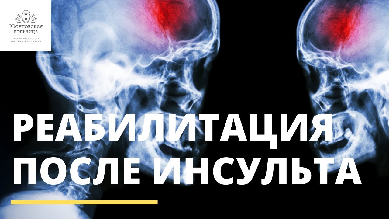 Ставим на ноги после инсульта