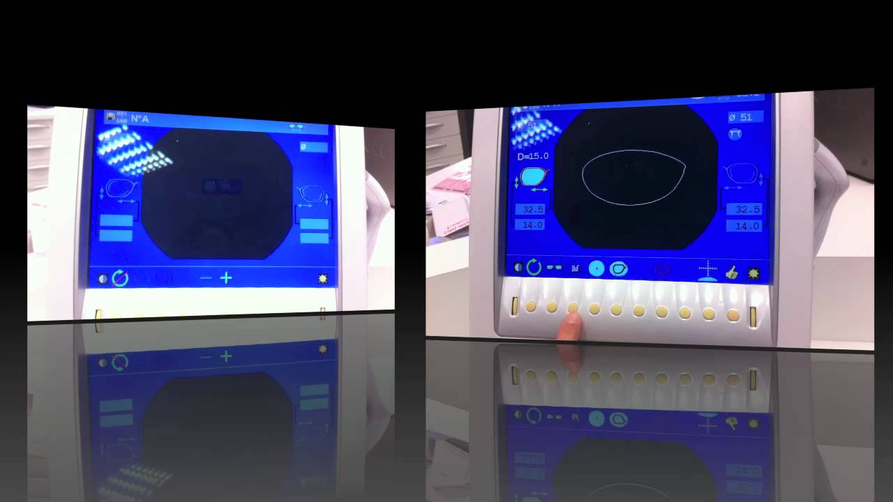 Bts OL Réalisation Kappa ctd Acquisition des trous