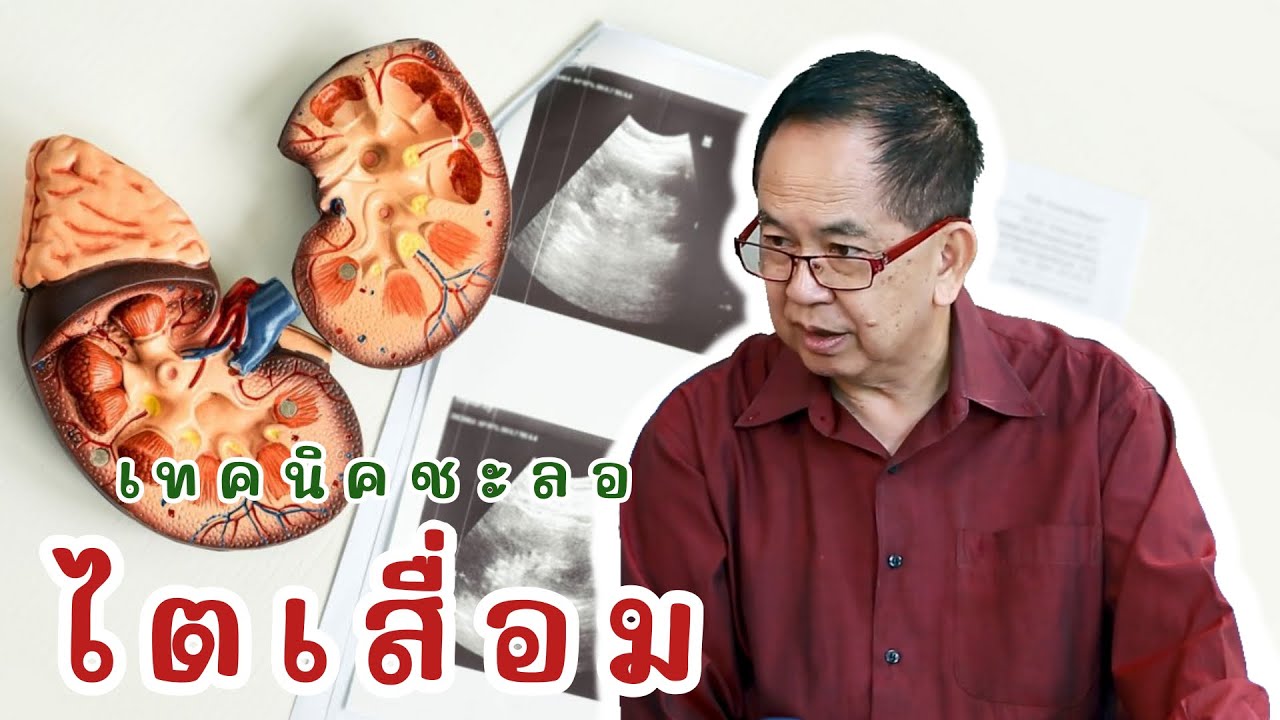 เทคนิคชะลอไตเสื่อม EP123/2 | ดร.นพ.พรเทพ ศิริวนารังสรรค์