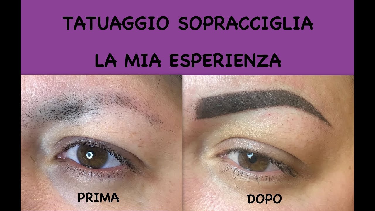 TATUAGGIO SOPRACCIGLIA: LA MIA ESPERIENZA! (con guarigione)
