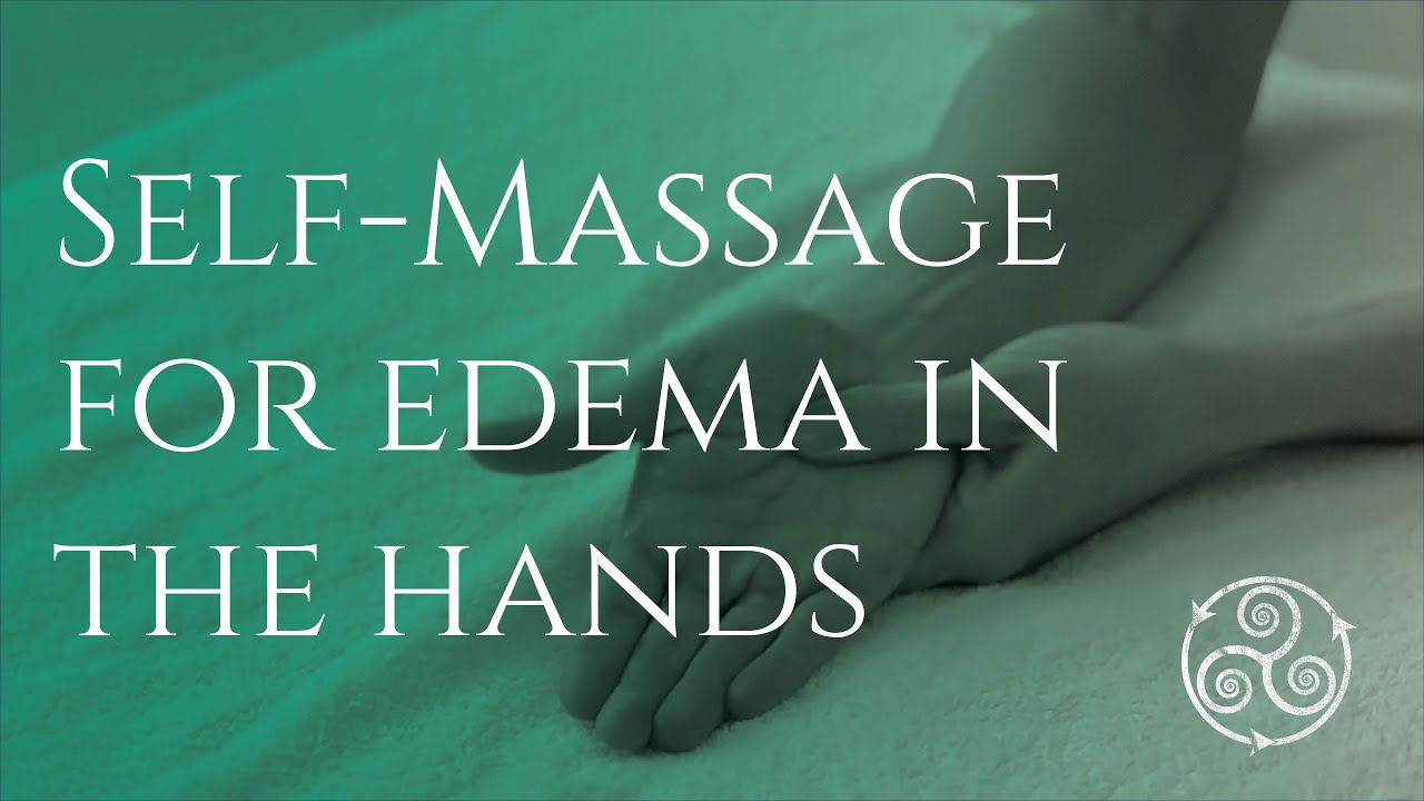 SELF MASSAGE FOR EDEMA IN THE HANDS