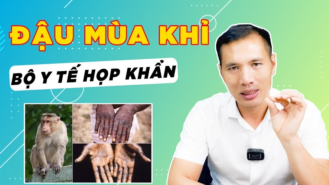 Cảnh báo: đậu mùa khỉ bùng phát - những triệu chứng nghiêm trọng cần biết ngay