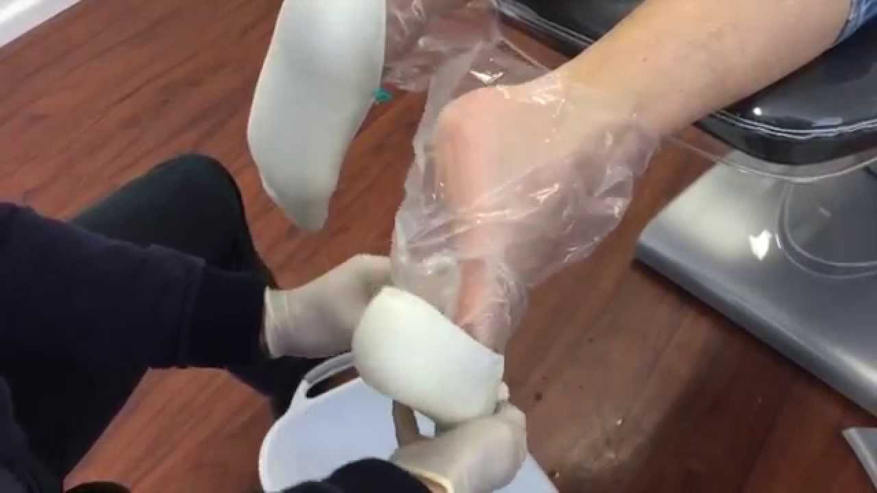Production of Custom made Foot Orthoses at Footwork Podiatric Laboratory