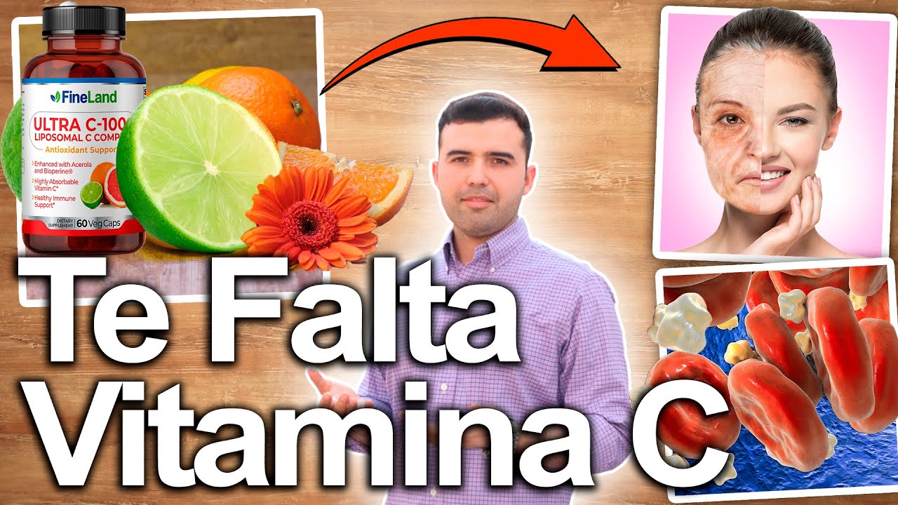 SÍNTOMAS DE FALTA DE VITAMINA C - Signos Y Síntomas Que Indican Deficiencia - Enfermedades