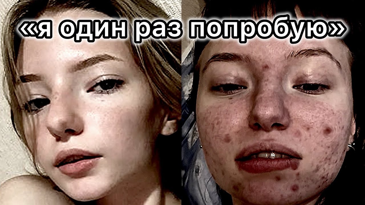 СТОРЧАЛАСЬ В 11 ЛЕТ
