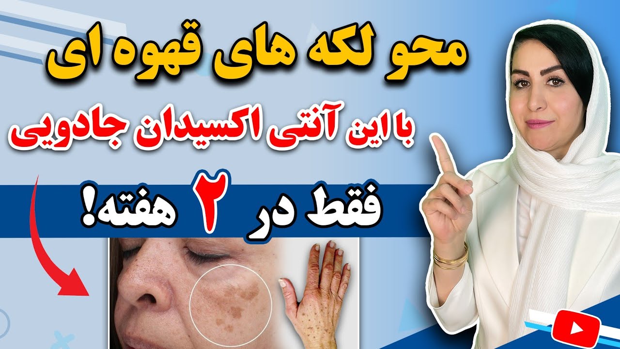 درمان لکه‌ های قهوه ای و لکه های پیری پوست دست و صورت بدون دارو و لیزر فقط در ۱۲ روز! 😮