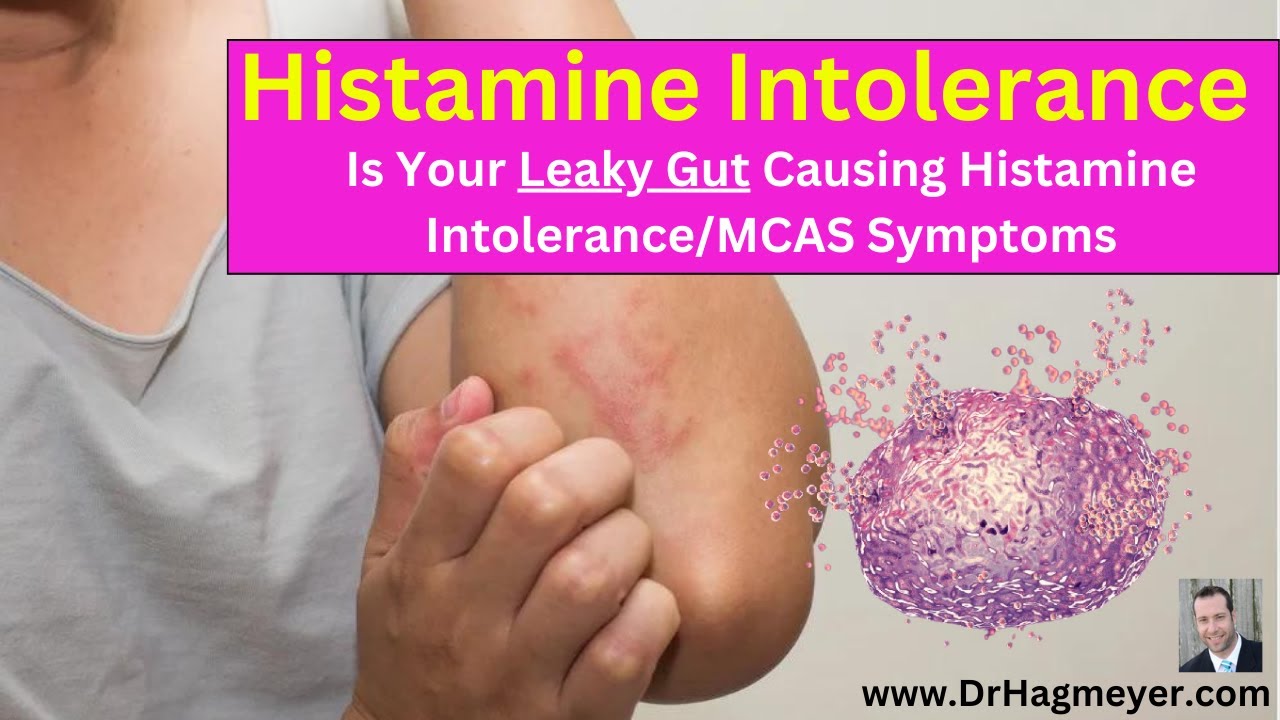 How Leaky Gut 💧Can Worsen Histamine Intolerance Symptoms👇🏻👇🏻