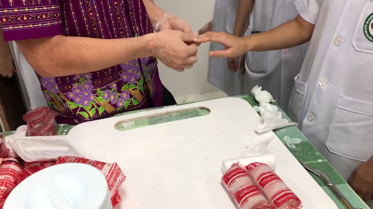 Buddy finger splint