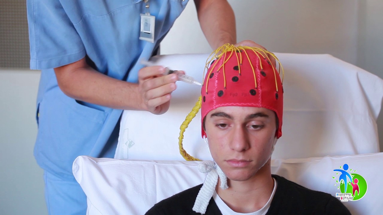 03 EEG VEGLIA - DOTTORE AMICO - ANDIAMO IN OSPEDALE