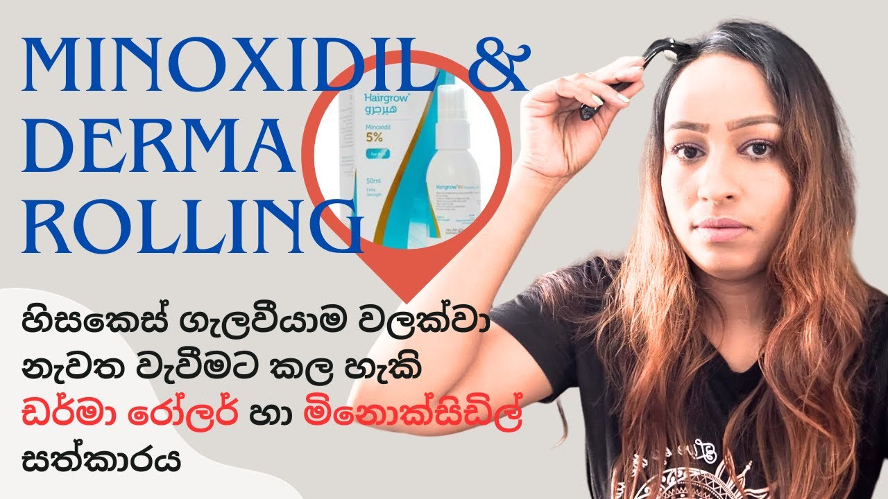 Minoxidil & Derma Rolling | හිසකෙස් ගැලවීයාම වලක්වා නැවත වැවීමට ඩර්මාරෝලර් හා මිනොක්සිඩිල් සත්කාරය