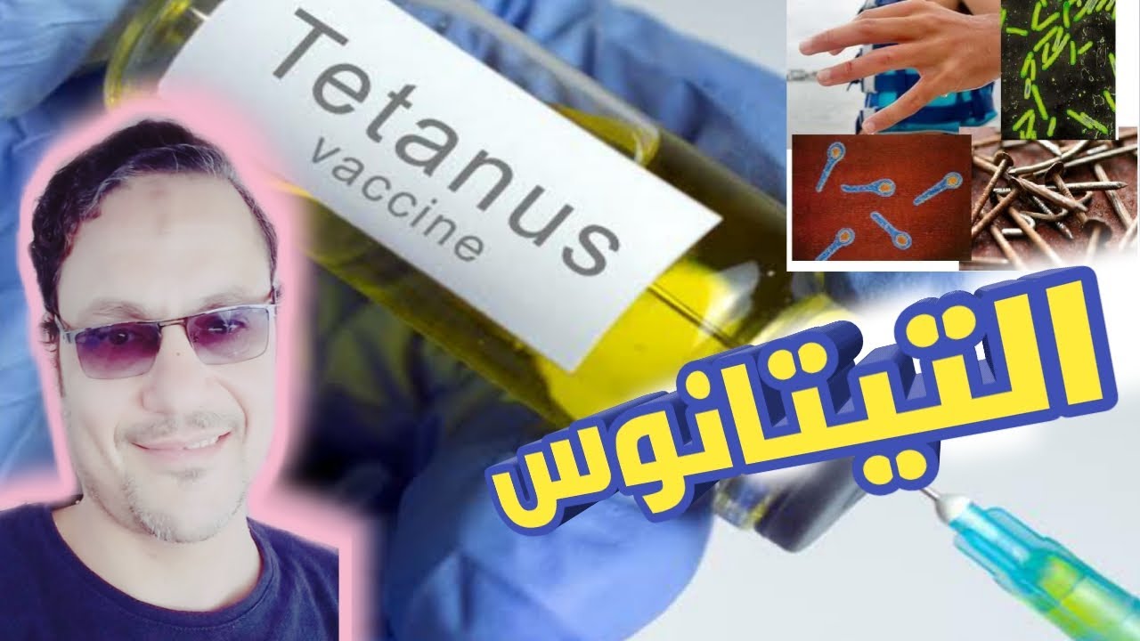 مرض التيتانوس ( الكزاز ) من الاصابة الي التعافي . اسبابه اعراضه مضاعفاته  علاجه   tetanus