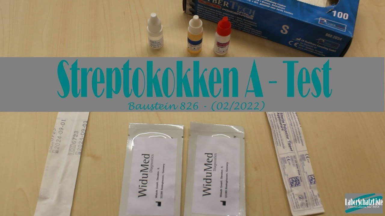 Streptokokken A-Test