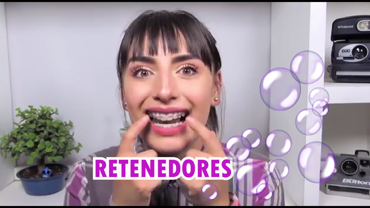 ⭐😬 TODO LO QUE DEBES SABER SOBRE RETENEDORES !!!! 😬⭐