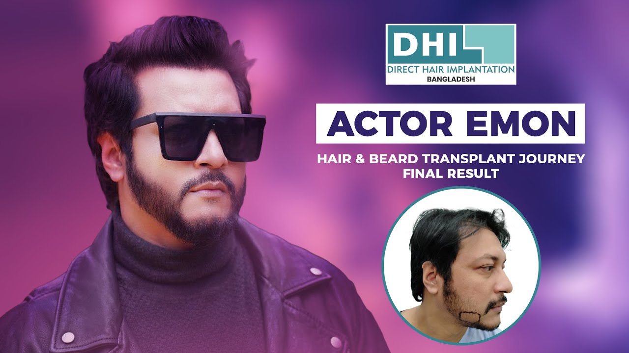 Hair Transplant Journey Of Actor Emon | Final Result | Best Hair Transplant | DHI Bangladesh