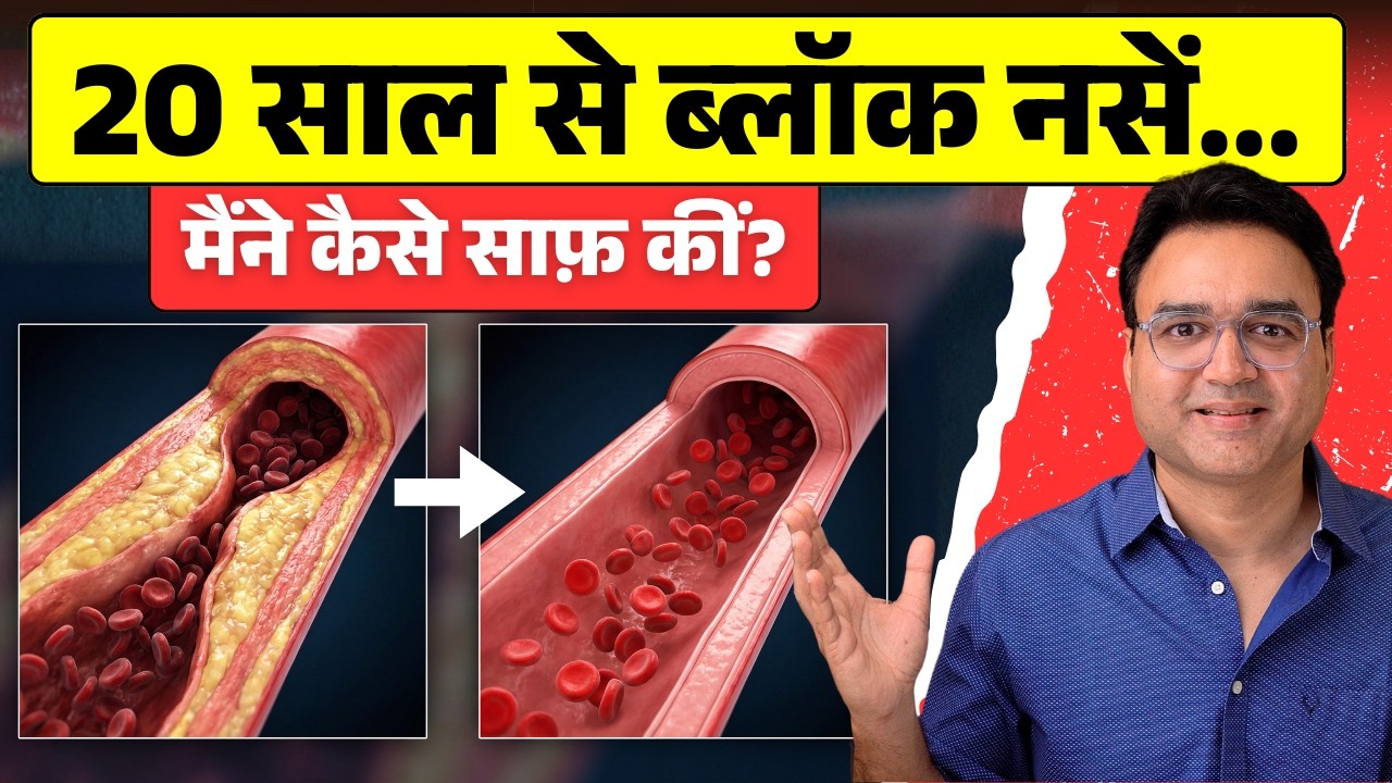 20 साल पुरानी नसों की ब्लॉकेज कैसे ख़त्म हुई? 😱 मेरी सच्ची कहानी | How I Reversed Arterial Plaque?