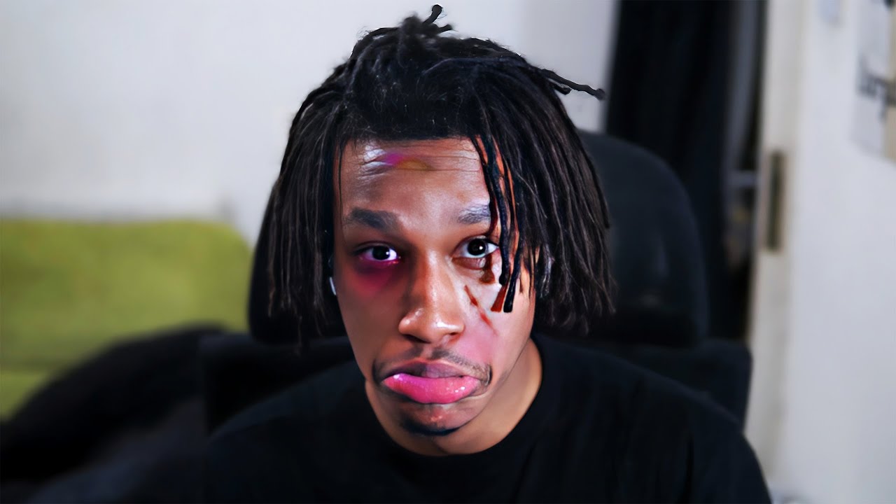 i got beat up...