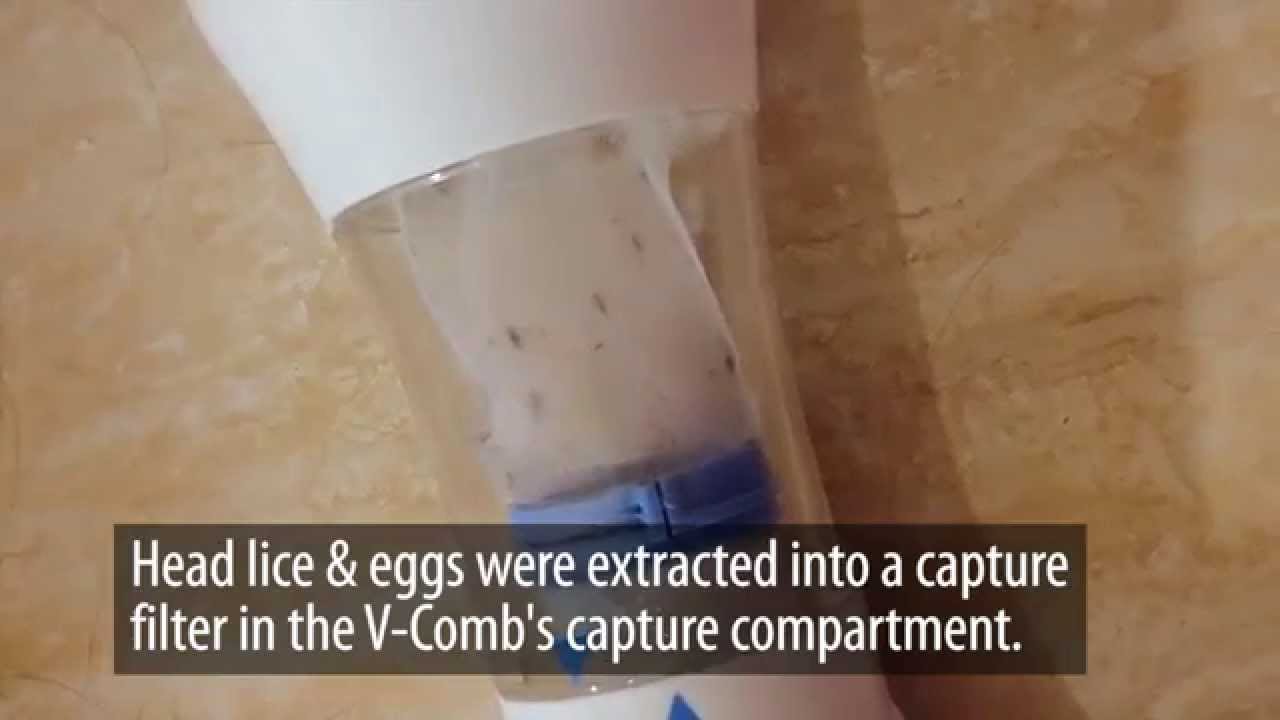 How to combat Head lice using LiceTec V-Comb