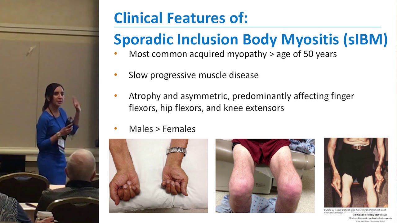 Myositis 101: A Primer For Beginners, Dr Namita Goyal 2017 Annual Patient Conference